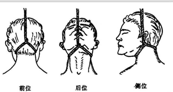 [图片] 我一直很疑惑 这个图片里的叙述 后位缢死(正吊)被归为非典型